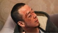 杨坤辟谣在长沙被人殴打相关传言:附解绷带趣味视频