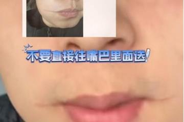忽略了铁签子的温度 男子吃烧烤被烫出“微笑唇”