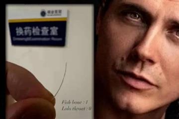 挽救了整个演出 法国演员感谢中国医生拔鱼刺